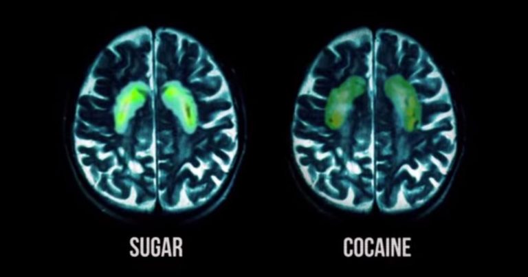 health-how-does-sugar-impact-the-brain-mcsm-rampage